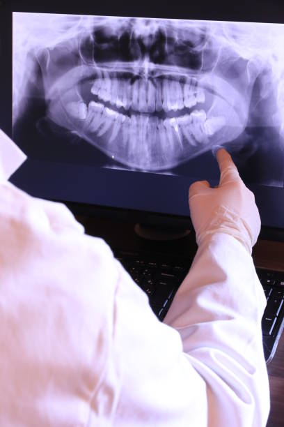 Best Emergency Tooth Extraction in Derby, CT