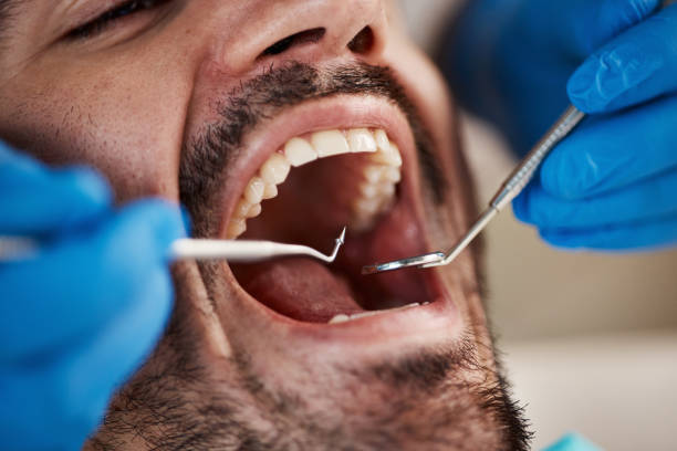 Best Emergency Dental Care for Trauma or Injury in Derby, CT