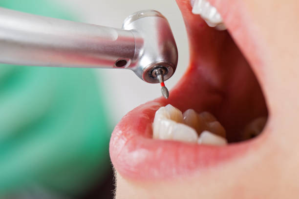 Best Emergency Dental Surgery in Derby, CT